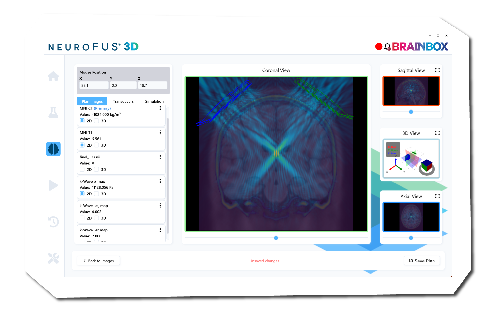 NEUROFUS 3D GUI
