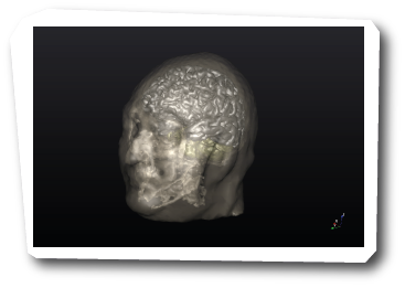 Convert MRI data to 3D Models for Computational Modelling