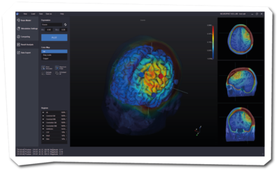 Neurophet tES Lab Graphical User Interface