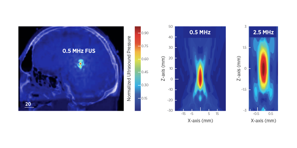 经颅聚焦超声刺激TUS 0.5Mhz刺激范围